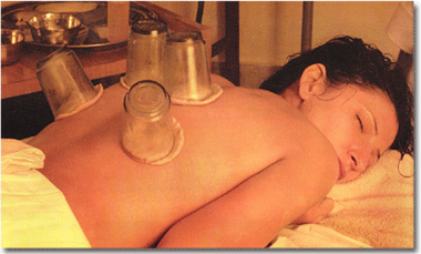 A woman benefiting from naturopathic treatment.